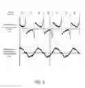 Fig. 09 - Position corrected pulse width modulation for brushless direct current motors