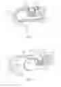 Fig. 04 - Gas turbine engine joint having a metallic member, a CMC member, and a ceramic key