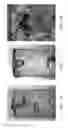 Fig. 11 - Gas turbine engine joint having a metallic member, a CMC member, and a ceramic key