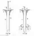 Fig. 15 - ANCHORING SYSTEM AND METHOD