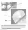 Fig. 30 - Microfluidic assay platforms