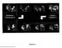 Fig. 12 - Fibrin-binding peptides and conjugates thereof