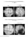Fig. 02 - IN VIVO DETECTION OF APOPTOSIS
