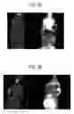 Fig. 04 - METHOD OF RADIOTHERAPY USING A RADIOLABELLED RGD PEPTIDE