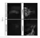 Fig. 13 - Method for treating vascular inflammation, improving skin beauty and improving male sexual function using ginseng berry