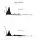 Fig. 17 - Method for activating natural killer cells by tumor cell preparation in vitro