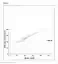 Fig. 07 - Use of platelet activating factor acetylhydrolase as a biomarker for anaphylaxis