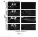 Fig. 02 - Therapeutic Applications Targeting SARM1