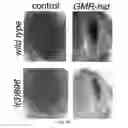 Fig. 06 - Therapeutic Applications Targeting SARM1