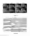 Fig. 02 - EP1 INHIBITION