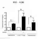 Fig. 04 - Method of reducing recurrence of multiple sclerosis symptoms in a mammal by administering an anti-repulsive guidance molecule neutralizing antibody