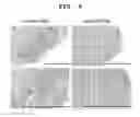 Fig. 08 - Method of reducing recurrence of multiple sclerosis symptoms in a mammal by administering an anti-repulsive guidance molecule neutralizing antibody