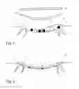 Fig. 02 - Wound Treatment Therapy