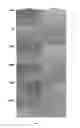 Fig. 07 - Amniotic membrane preparations and purified compositions and anti-inflammation methods