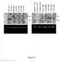 Fig. 48 - Methods and compositions for categorizing patients