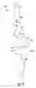 Fig. 13 - Device, systems and methods for evaluation of hemostasis