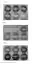Fig. 02 - HIGH THROUGHPUT SCREENING OF LACTIC ACID-PRODUCING MICROORGANISM