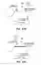 Fig. 80 - METHODS FOR MANUFACTURING MICROWELL STRUCTURES OF CHEMICALLY-SENSITIVE SENSOR ARRAYS