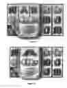 Fig. 09 - Method of gaming, a gaming system and a game controller