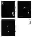 Fig. 08 - METHODS AND COMPOSITIONS FOR DISRUPTING BIOFILM UTILIZING CHITOSAN-DERIVATIVE COMPOUNDS