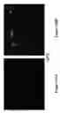 Fig. 17 - METHODS AND COMPOSITIONS FOR DISRUPTING BIOFILM UTILIZING CHITOSAN-DERIVATIVE COMPOUNDS