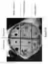 Fig. 25 - METHODS AND COMPOSITIONS FOR DISRUPTING BIOFILM UTILIZING CHITOSAN-DERIVATIVE COMPOUNDS