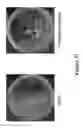 Fig. 34 - METHODS AND COMPOSITIONS FOR DISRUPTING BIOFILM UTILIZING CHITOSAN-DERIVATIVE COMPOUNDS