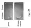 Fig. 35 - METHODS AND COMPOSITIONS FOR DISRUPTING BIOFILM UTILIZING CHITOSAN-DERIVATIVE COMPOUNDS