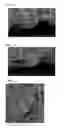 Fig. 02 - Coating composition