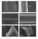 Fig. 01 - Spider silk proteins and methods for producing spider silk proteins