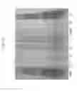 Fig. 16 - SOY WHEY PROTEIN COMPOSITIONS AND METHODS FOR RECOVERING SAME