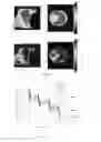 Fig. 03 - RADIOTHERAPY PHANTOM