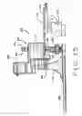 Fig. 13 - OPEN FIELD SYSTEM FOR MAGNETIC SURGERY