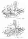 Fig. 19 - OPEN FIELD SYSTEM FOR MAGNETIC SURGERY