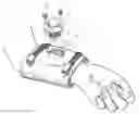 Fig. 01 - ORTHOPAEDIC DEVICE AND METHOD OF USE FOR TREATING BONE FRACTURES