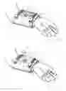 Fig. 06 - ORTHOPAEDIC DEVICE AND METHOD OF USE FOR TREATING BONE FRACTURES