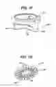 Fig. 06 - Fluid removal in a surgical access device