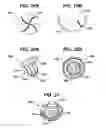 Fig. 22 - Fluid removal in a surgical access device