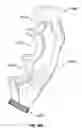 Fig. 23 - Laryngoscope and method of use