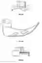 Fig. 44 - Laryngoscope and method of use
