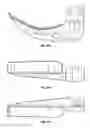Fig. 45 - Laryngoscope and method of use