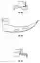 Fig. 46 - Laryngoscope and method of use