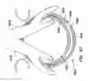 Fig. 68 - Wound retractor with gel cap