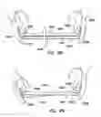 Fig. 69 - Wound retractor with gel cap