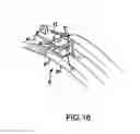Fig. 12 - THORACIC RETRACTORS AND METHODS