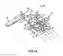 Fig. 14 - THORACIC RETRACTORS AND METHODS