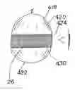 Fig. 01 - Device for the Delineation of Cardiovascular or Other Anatomical Structures