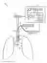 Fig. 01 - Method and system for determining placement of a tracheal tube in a subject