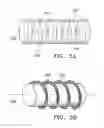 Fig. 05 - Subcutaneous cavity marking device