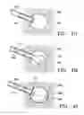 Fig. 09 - Subcutaneous cavity marking device